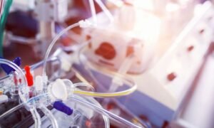 CERAMICS Trial Shows 71 Percent Survival with Early MCS and Escalation in AMI Cardiogenic Shock