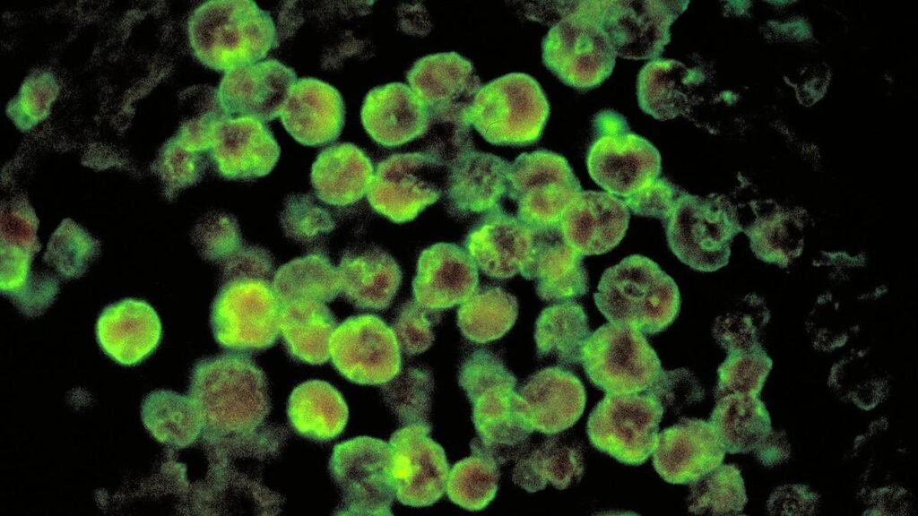 Brain-eating amoeba: Kerala reports another death from amoebic meningoencephalitis