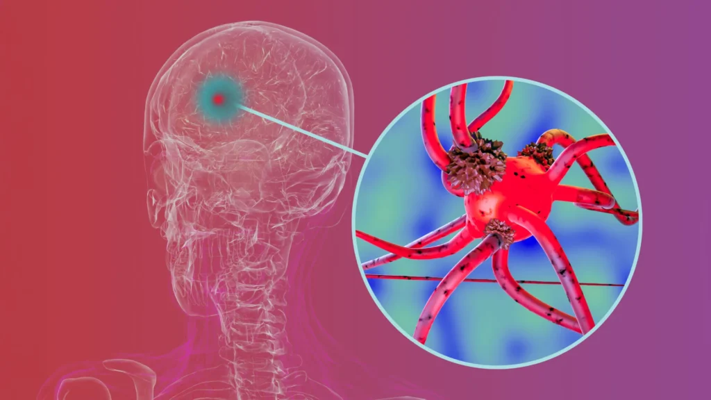 Researchers block key protein that helps Parkinson’s spread through the brain