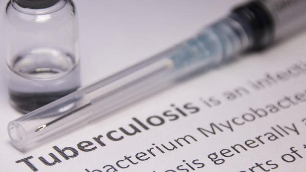 Tuberculosis death rates decline in 6 districts after roll-out of Kasanoi Erappila Thittam, finds study