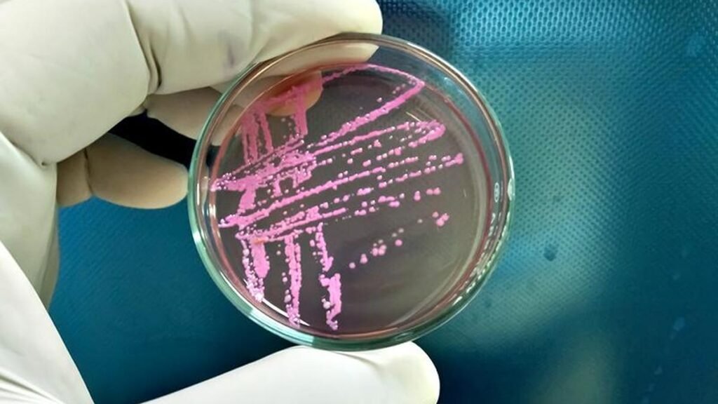 Shigella | Virulent bacterium – The Hindu