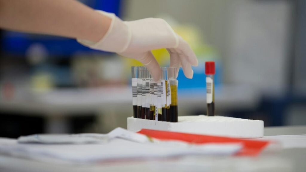 Scientists find a blood test that predicts lung cancer years early
