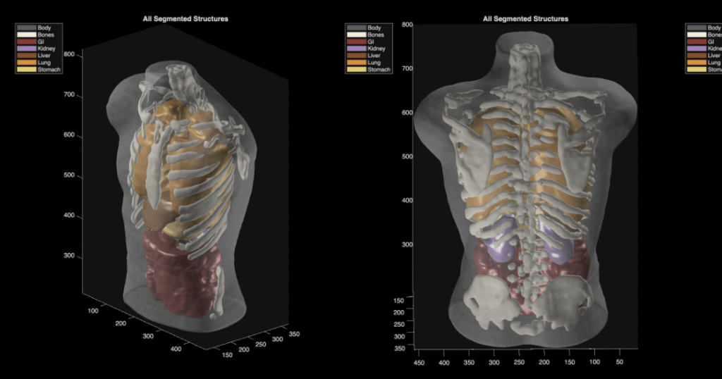 Midjourney Medical goes from AI image generation to full-body ultrasounds