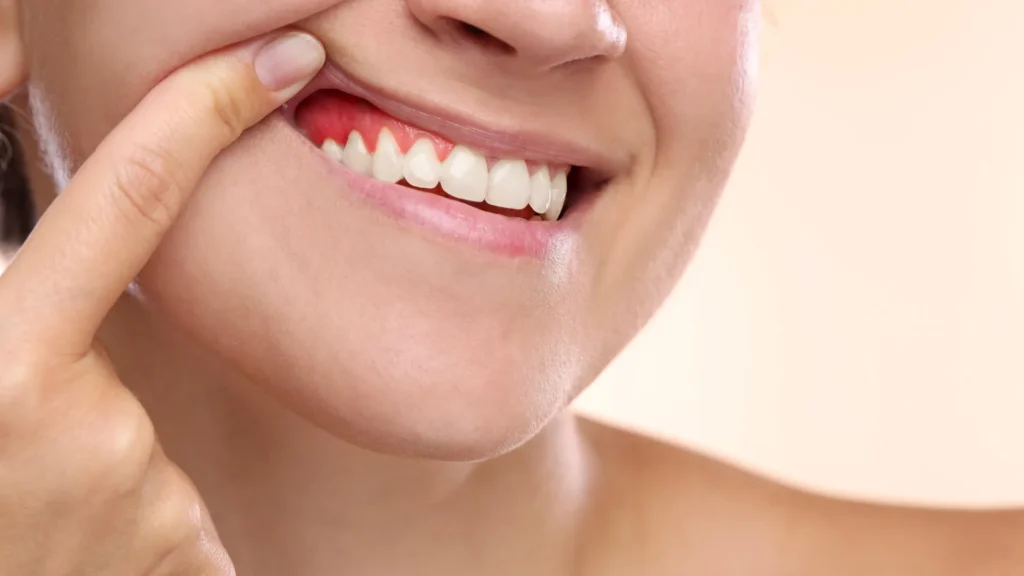 This giant tropical fruit could help reverse gum disease damage