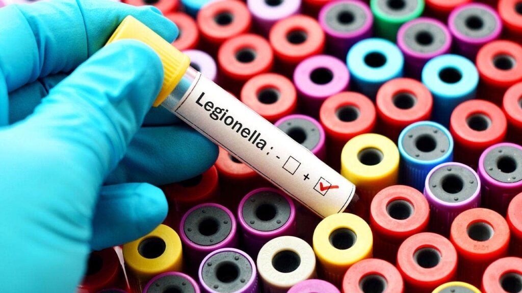 New York City Legionnaires’ disease kills 4 on the Upper East Side