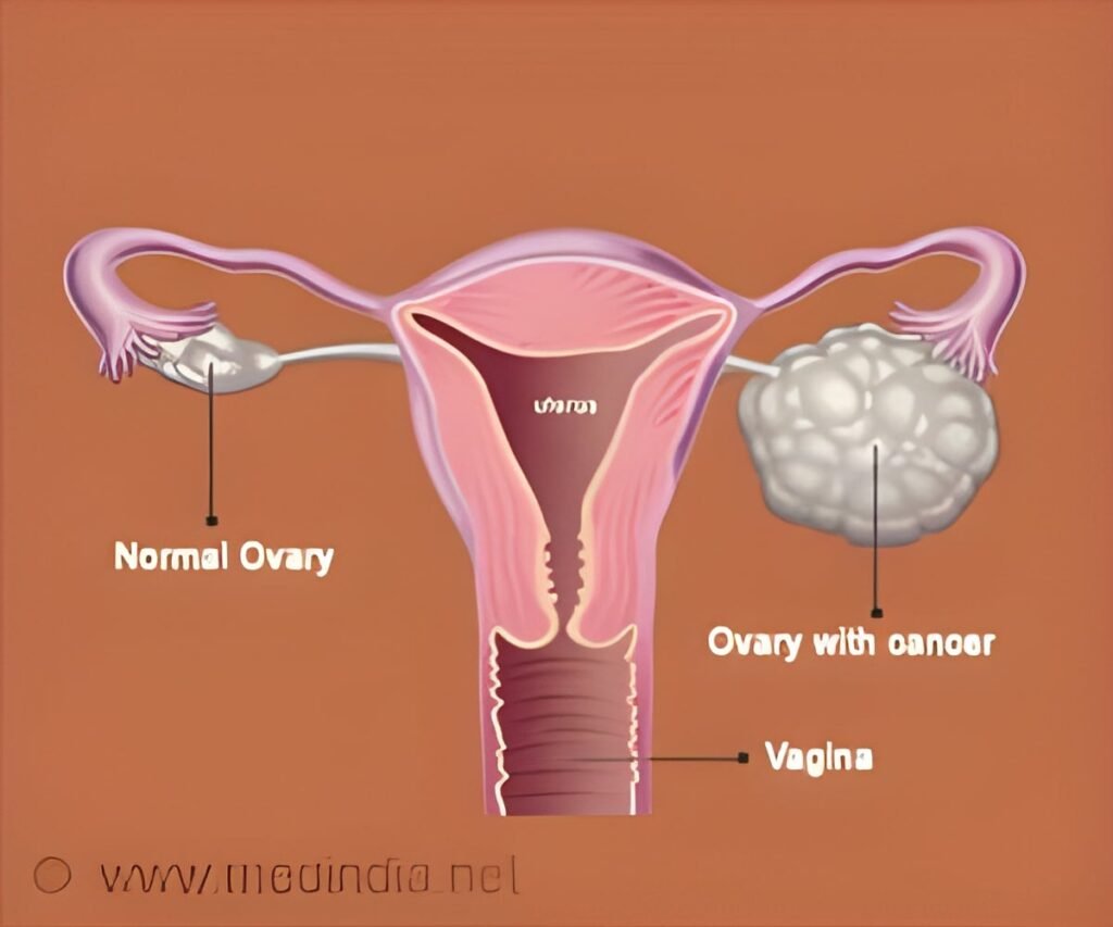 The Importance of Early Diagnosis