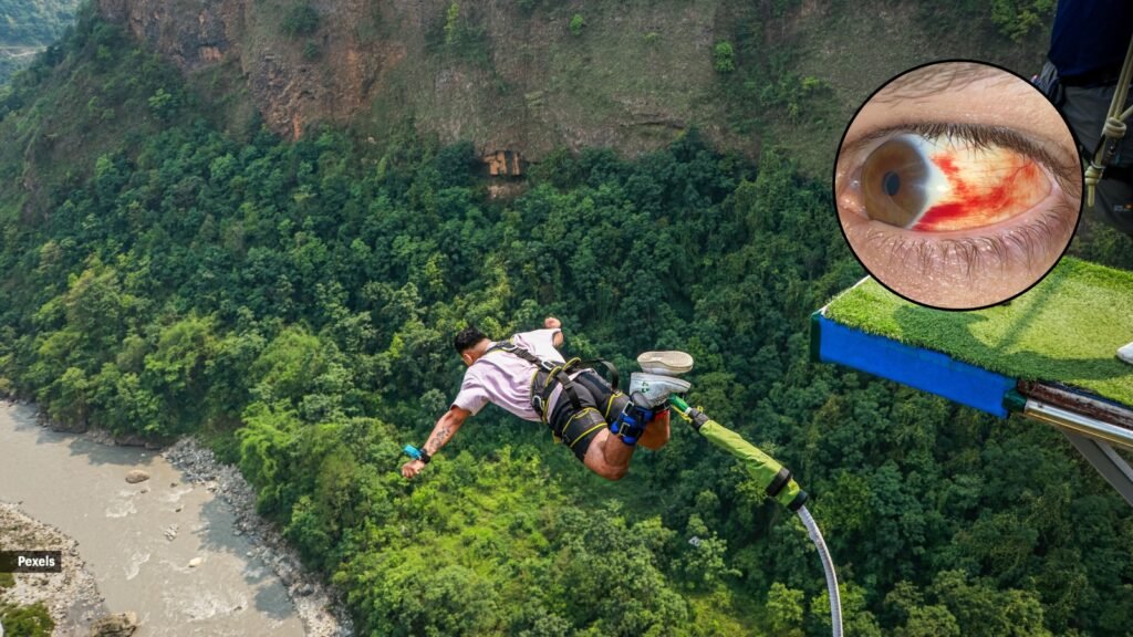 Bloodshot Eyes After Bungee Jumping Are Going Viral—Should You Worry?