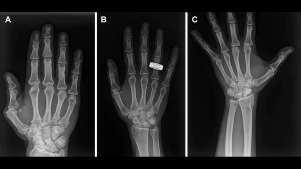 1st-ever X-rays in space offer hope for possible patients headed to the moon