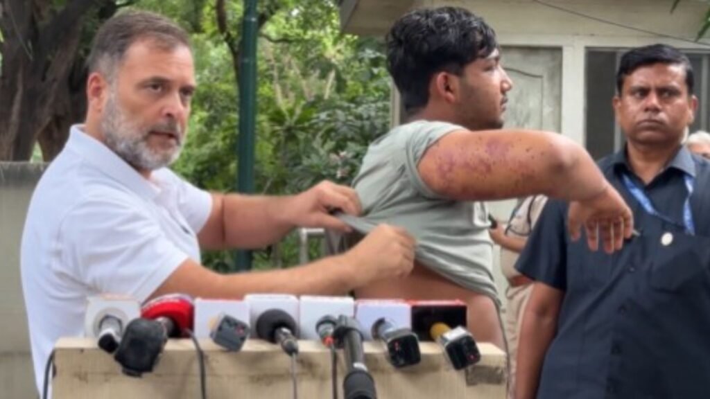 Pellet-hurt student by his side, Rahul Gandhi slams Dharmendra Pradhan, demands apology from PM Modi | India News