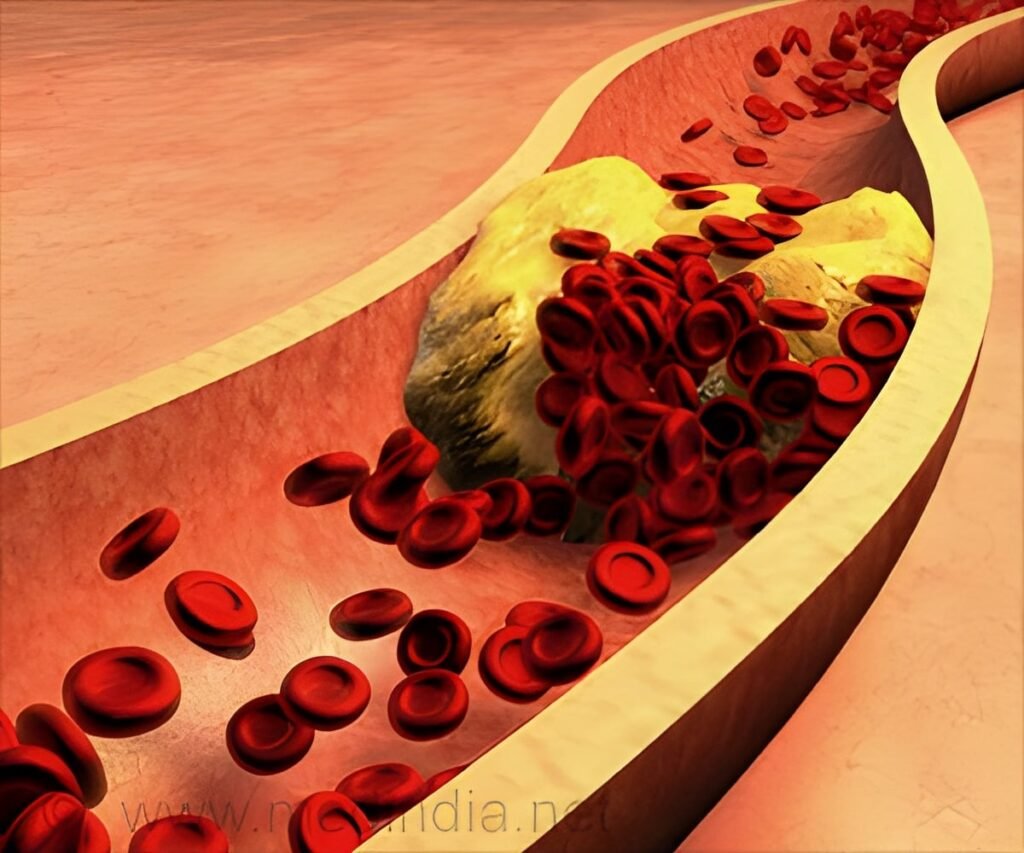 High Cholesterol Myths You Should Stop Believing