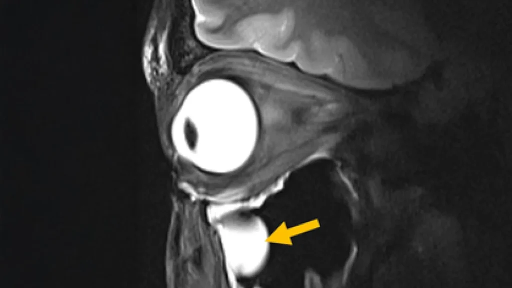 New MRI breakthrough reveals the brain and eye like never before