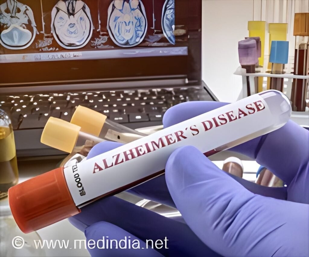 Alzheimer’s Blood Tests Show Promise for People With Down Syndrome