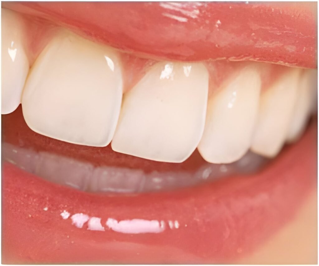 Are Dental Implants Becoming Obsolete?