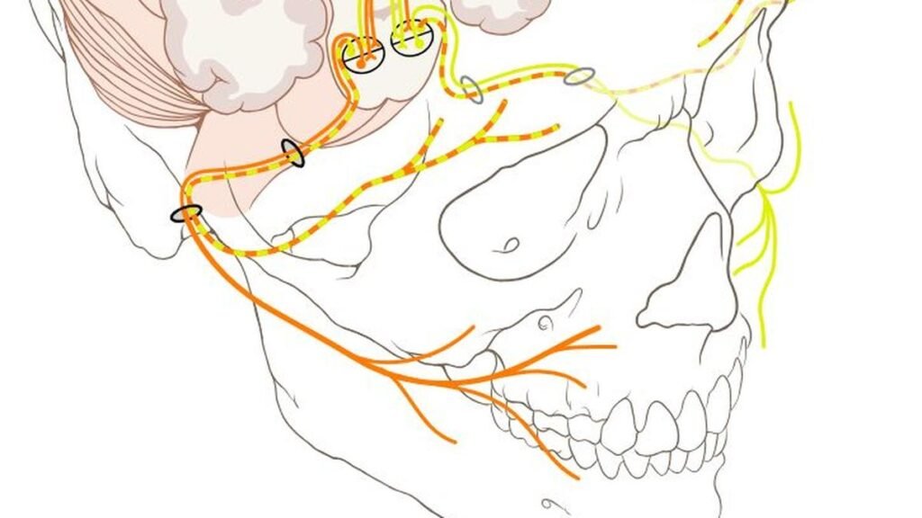 When one side of your face won’t stop twitching