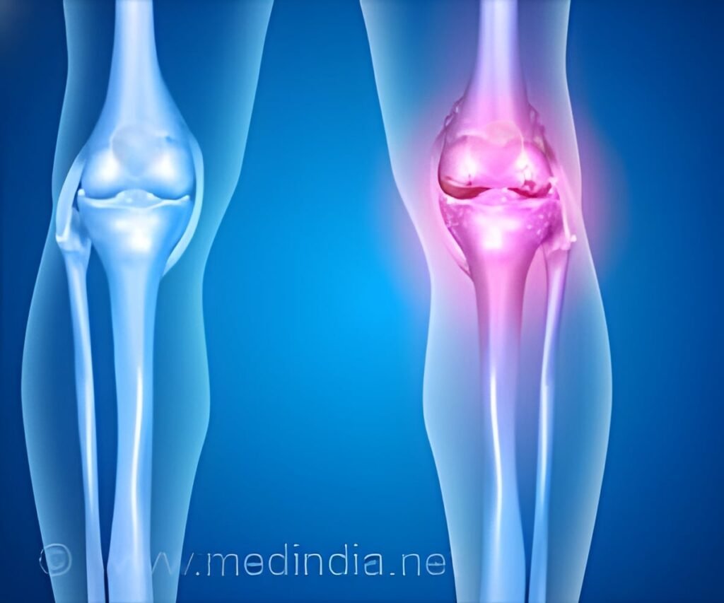 Why More Fitness Enthusiasts Need Joint Surgery