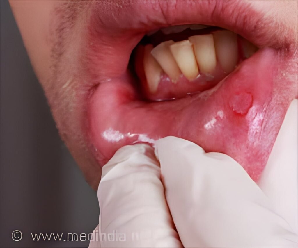 Can Poor Oral Hygiene Increase Your Oral Cancer Risk?