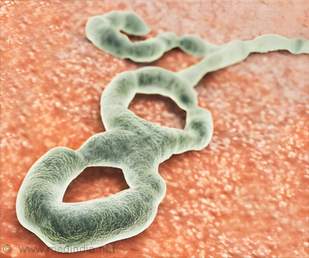 DR Congo Battles World’s Second Largest Ebola Epidemic