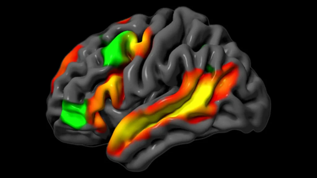 MIT neuroscientists discover the brain can reason without words
