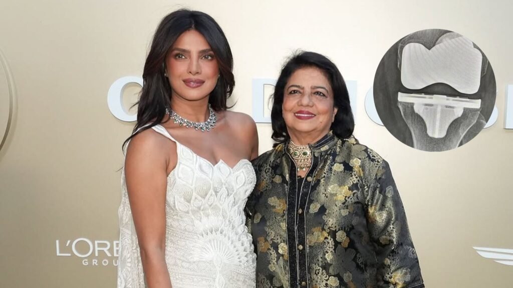 Priyanka Chopra’s mother Madhu Chopra undergoes knee replacement: When is surgery needed?