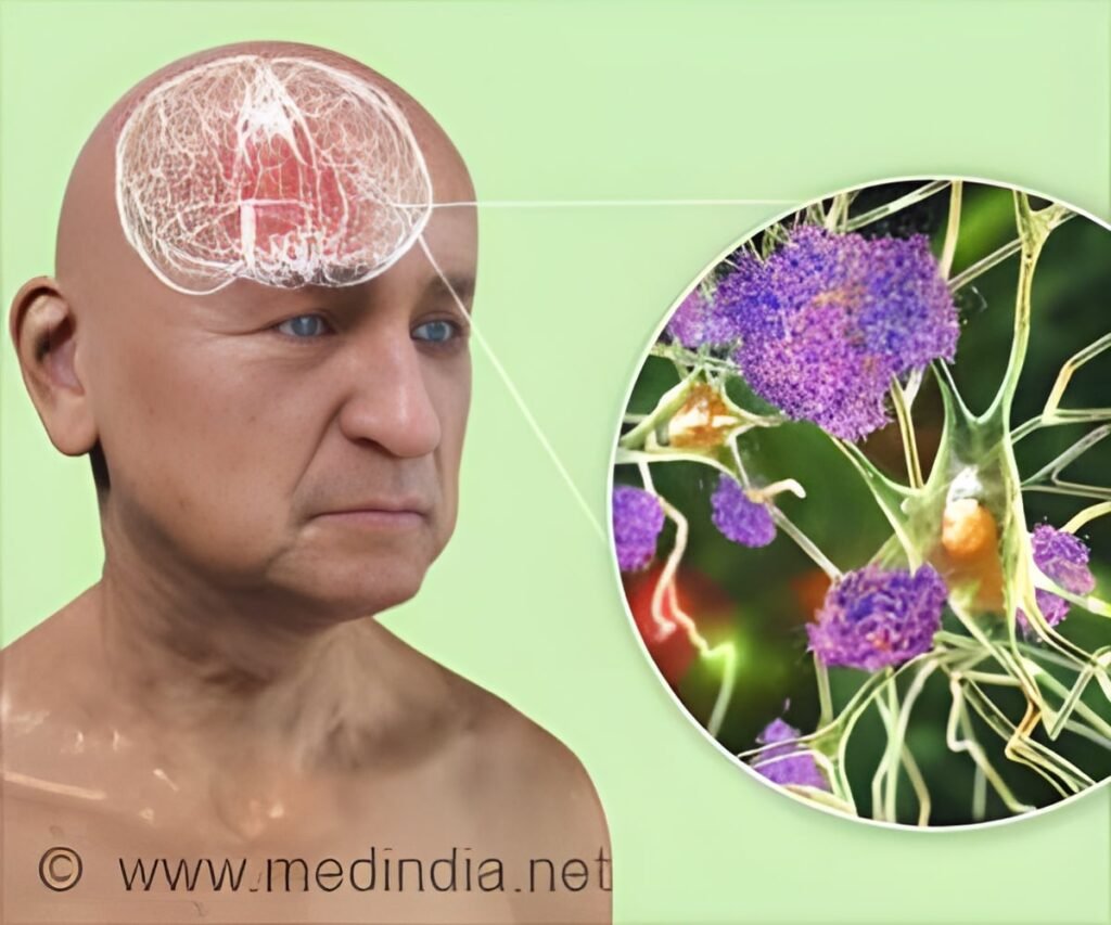 Early Mitochondrial Plaques Identified as a New Alzheimer’s Disease Target